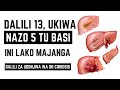 Dalili 13 Za Mwanzo Za Ugonjwa Wa Ini Ukiziona Tu Basi Wahi Hospitali Chap Dalili 13 Za Mwanzo Za Ugonjwa Wa Ini Ukiziona Tu Basi Wahi Hospitali Chap