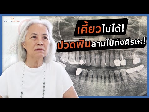 รีวิวจากคนไข้