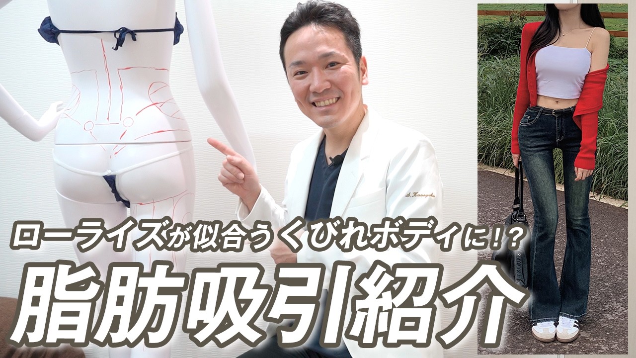 【骨格ストレート】ストレートさんあるある、ダイエットで減らない脂肪を1回の脂肪吸引で理想のくびれボディに！ローライズが似合うようになるおすすめの脂肪吸引を紹介！【モッズクリニック】