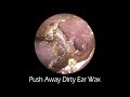 Push Away Dirty Ear Wax With Relaxing Music And Forest Background