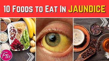 ✅ 10 Foods Eat When You Managing Jaundice || Jaundice Diet