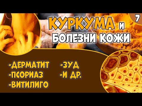 КУРКУМА (видео 7): болезни кожи. Псориаз. Дерматит. Витилиго.