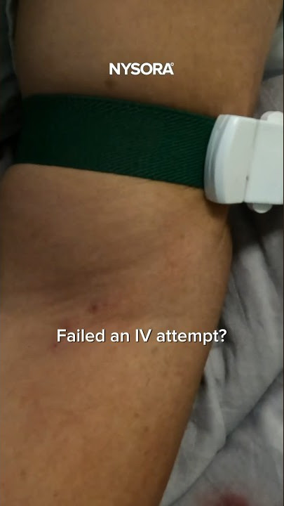 Don't release the tourniquet! #cannulation #iv #intravenous #veins #tourniquet