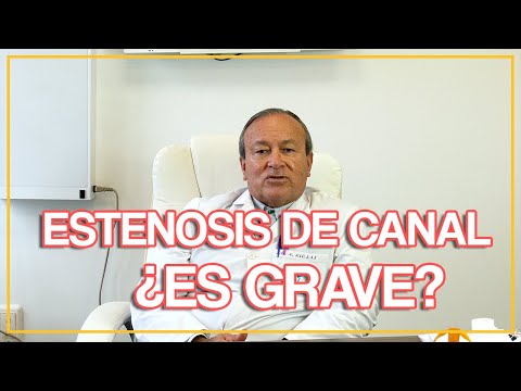 Video: ¿Puede empeorar el estrechamiento de la columna?