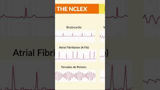 MOST IMPORTANT ECG IN NCLEX #nclexstudyguide #exam #aims #norcet #motivation #preparationtips