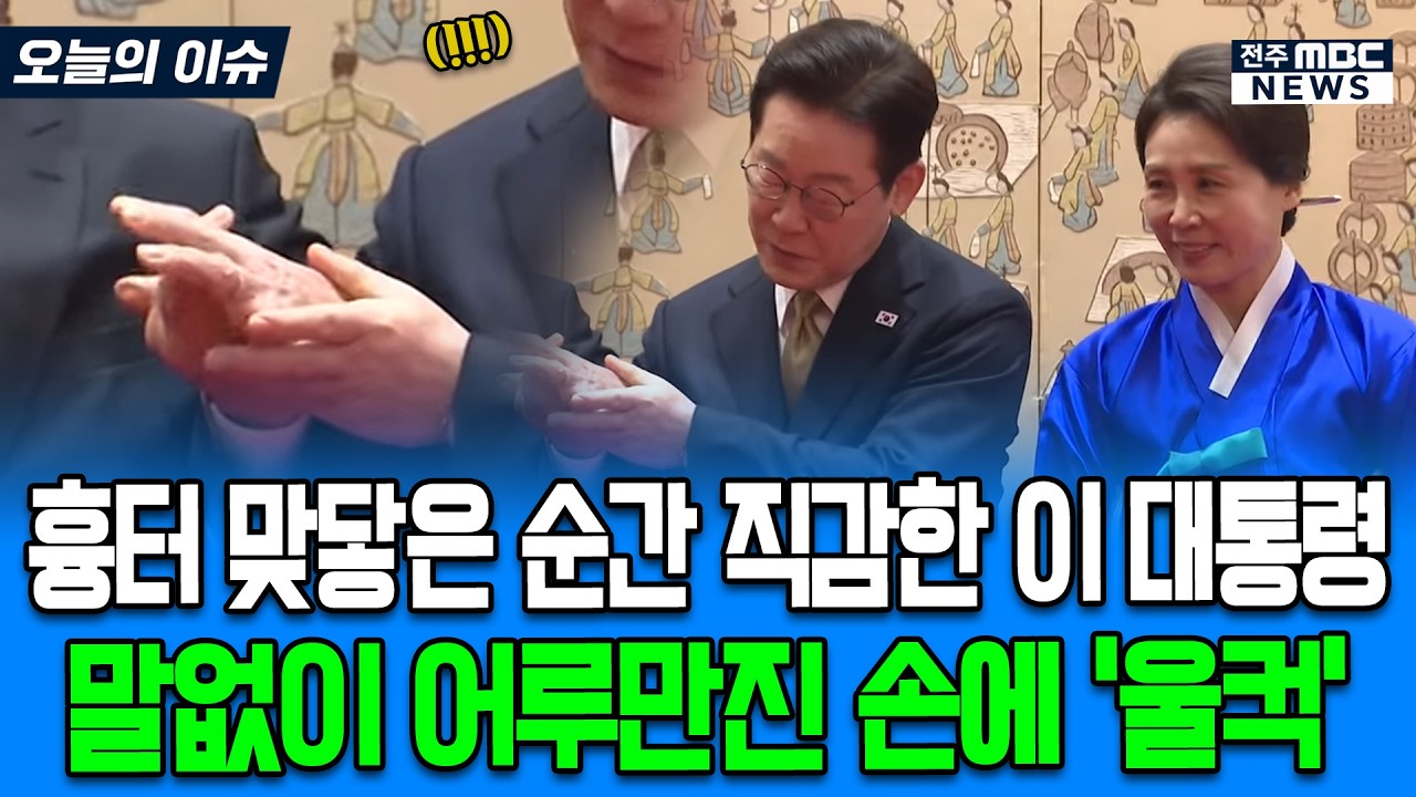 흉터 맞닿은 순간 직감한 이 대통령 말없이 어루만진 손에 '울컥'