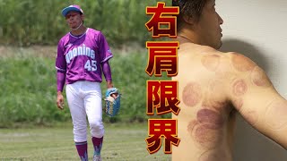 クーニンの右肩が限界…アザだらけ