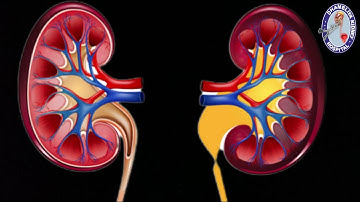 Pyeloplasty surgery| Ureteropelvic Junction Obstruction|(UPJ)| Dhameliya Kidney Hospital