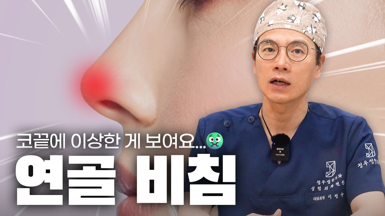 수술 후 코끝 연골 비침, 원인부터 해결 방법까지!