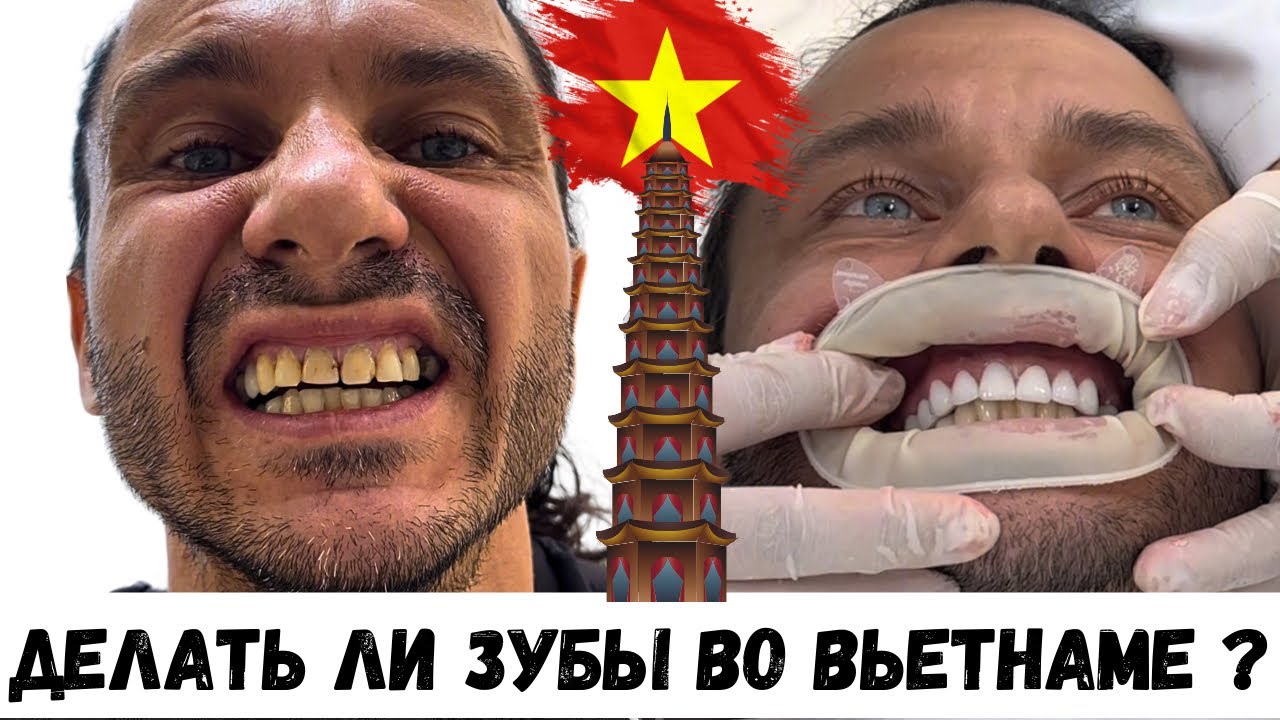ВЬЕТНАМ 2| НЯЧАНГ 4| В Хошимин за новыми зубами, вся правда о местной стоматологии.