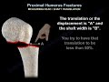 Proximal Humerus Fracture - Everything You Need To Know - Dr. Nabil Ebraheim