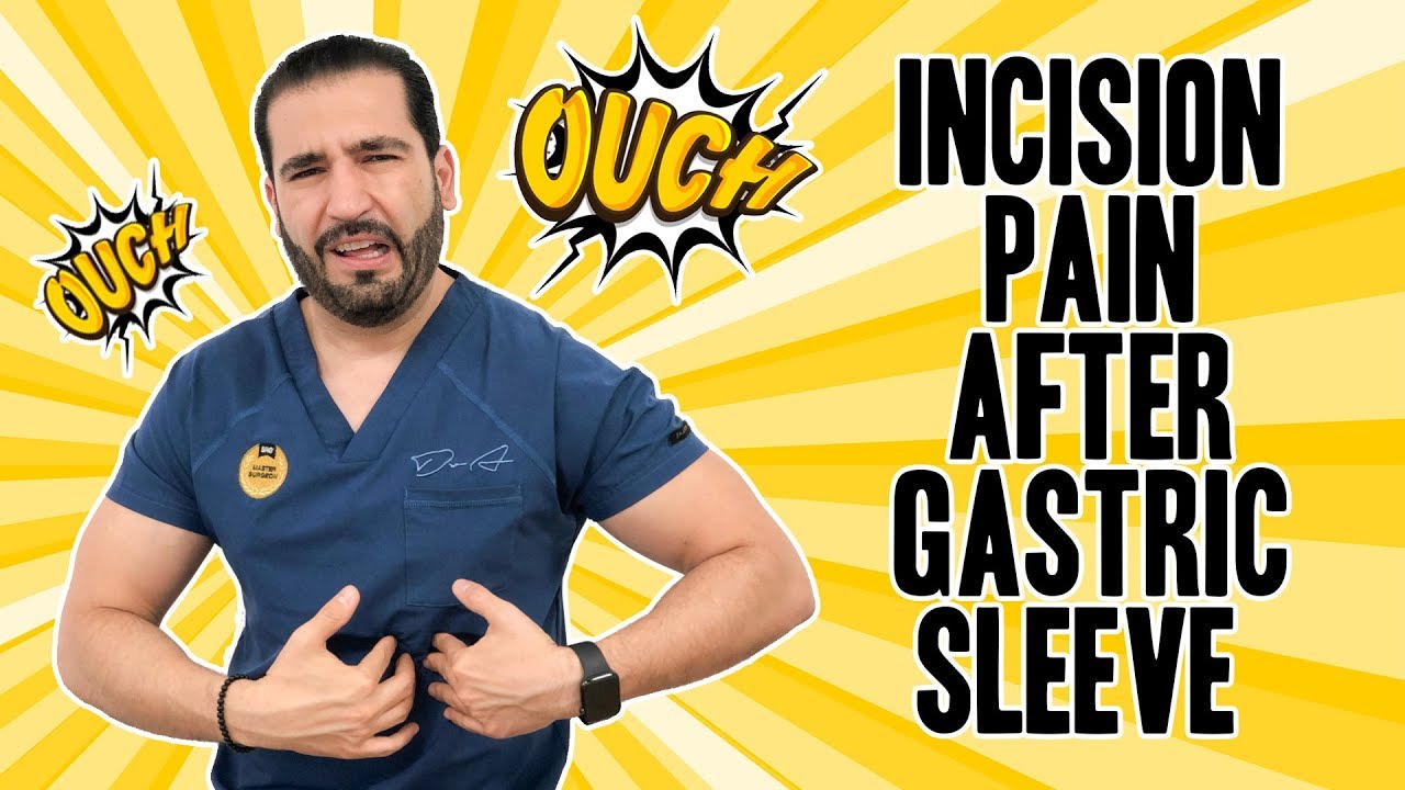 Incision Pain After Gastric Sleeve | Vertical Sleeve Gastrectomy | Questions And Answers