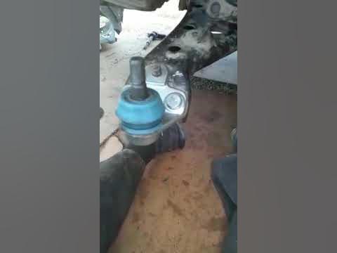 В Новосибирске спасателям пришлось снимать кольцо с опухшего пальца сибирячки - 