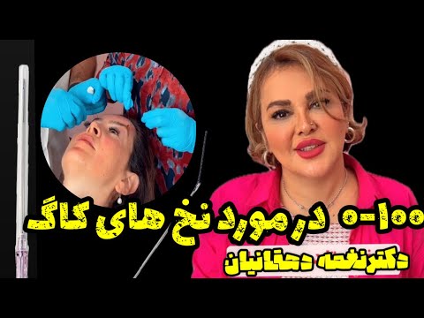 پروسه یک لیفت صورت با نخ های کاگ ومونورا