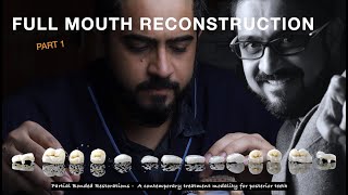 Full Mouth Reconstruction using Table Top Concepts: Part 1 #FMR, #emax