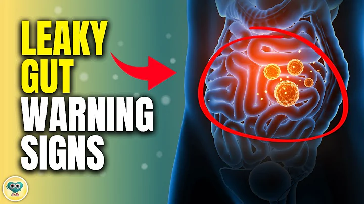 10 Signs That You Have A Leaky Gut