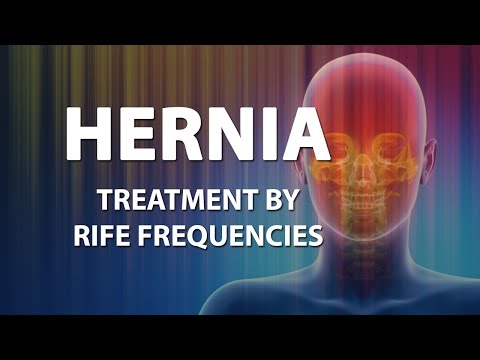 Hernia - RIFE Frequencies Treatment - Energy &amp; Quantum Medicine with 