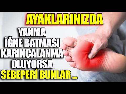 Video: Yumuşak Ayaklarda şiddet