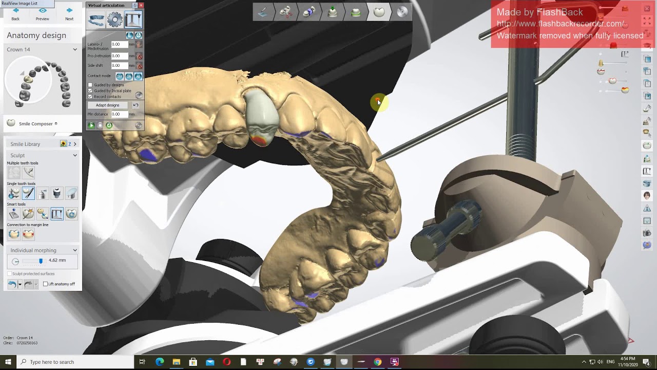 Single crown design with 3Shape Dental Studio - YouTube