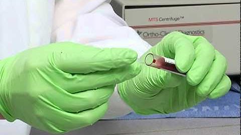 2 Platelet Count:  Diluting