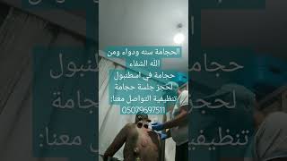 الحجامة سنه ودواء ومن الله الشفاء حجامة في اسطنبول لحجز جلسة حجامة تنظيفية التواصل معنا:05079697511