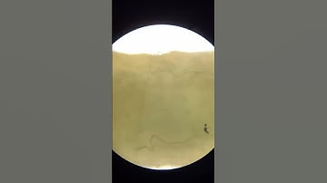 Exploring Noodles Under the Microscope 🔬 |  Close-Up View