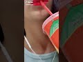 ياخي مو المهم فتركنة المهم دست علة راسك ال الا