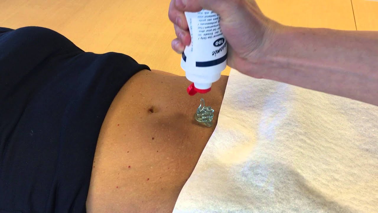 VitaScan LT Bladder Scanner: Comment Effectuer un scan réussi