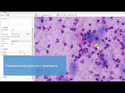 Video: Flowmetry Puncak - Petunjuk, Hasil, Norma, Diagnostik