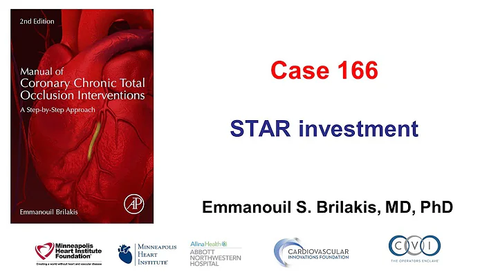 Case 166: Manual of CTO PCI - STAR investment