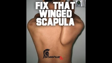 Winged Scapula Repair Protocol | Trevor Bachmeyer | SmashweRx