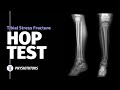 Hop Test  Tibial Stress Fractures