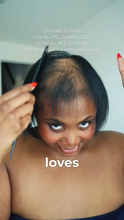 DIY Hair Topper Using A Lace Closure For #alopecia #hairloss