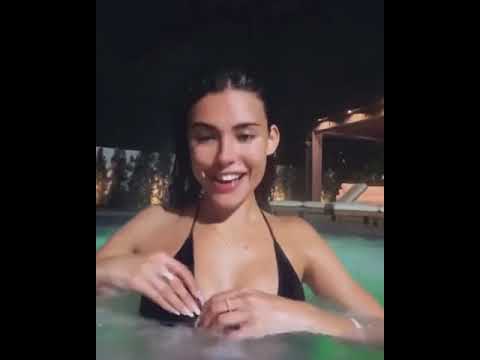 Twitch Nips