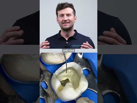 Video: Während der endodontischen Behandlung werden die Pulpakanäle gespült mit?