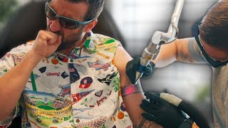 Tattoo Laser Removal: Our (Painful) Experience | Sorry Mom