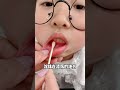 口腔潰瘍好難受怎麼辦 一招搞定馬上就不疼啦 口腔潰瘍好難受怎麼辦 一招搞定馬上就不疼啦