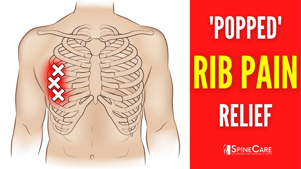 How to Fix a Rib Out of Place 