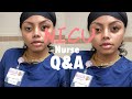 NICU Nurse Q&A