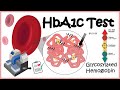 HbA1c Test ( Glycosylation of haemoglobin) | Diabetes