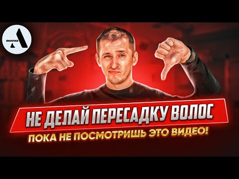 Всё что нужно знать о пересадке волос в 2023 году!