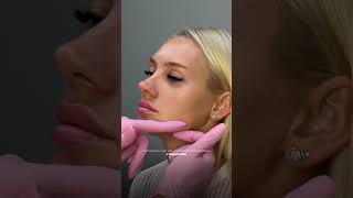 Делаем Чёткий Овал Лица Проверенная Пошаговая Схема От Косметолога