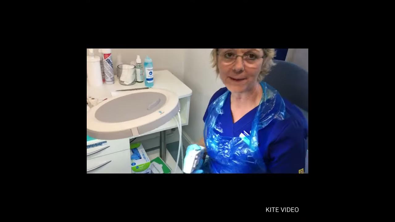 Using Doppler to check foot pulses YouTube