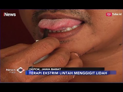 Video: Pengobatan Dengan Lintah (hirudoterapi) - Pandangan Alternatif