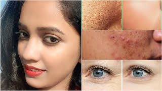 7 Day Challenge - Remove Open Pores Wrinkles Blackheads Wrinkles Permanently / Anti Aging Secret
