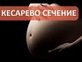 Безопасно ли кесарево сечение? Отвечает акушер гинеколог ПМЦ Мать и Дитя.