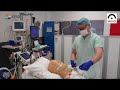 Extubation dun patient en contexte covid19