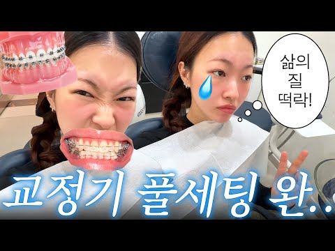 .📉 교정푸드 <strong>추천</strong>, <strong>미니</strong> 택배깡, 등촌칼국수 도전기,,,😭