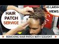 Hair patch Service for Men | Hair Wig Service in Delhi | Step-by-Step Details of Hair Patch Service