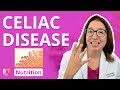 Celiac Disease Quiz
